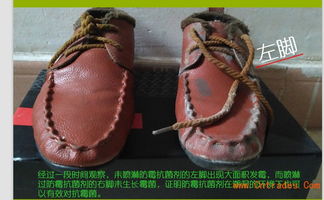 鞋子防霉剂 鞋类通用防霉抗菌喷雾剂